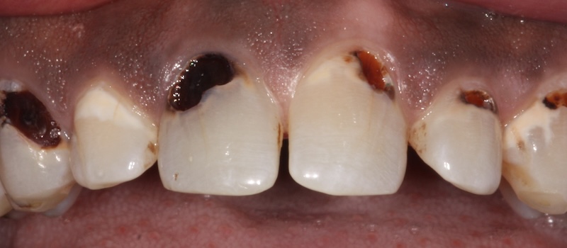 Before treatment