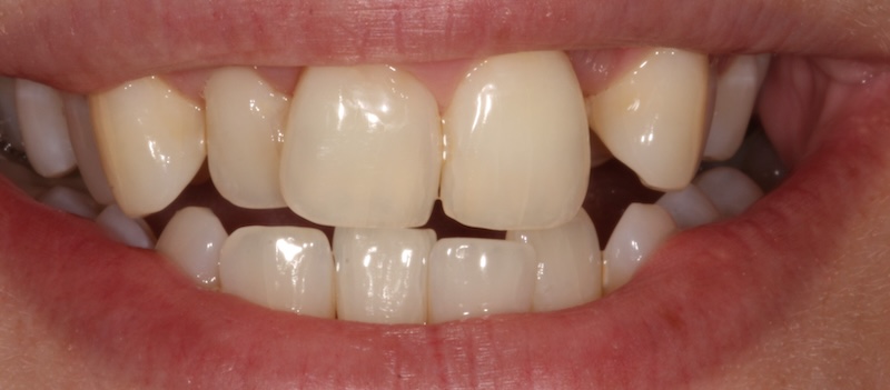 Before treatment
