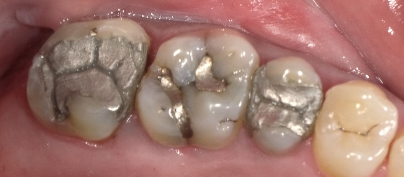 Before treatment